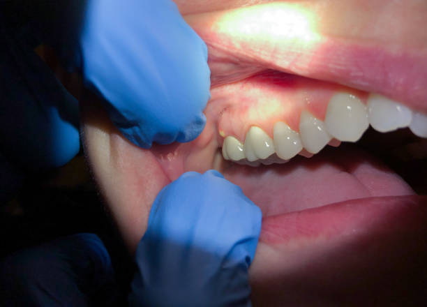 Best Weekend Emergency Dentist in Walkersville, MD