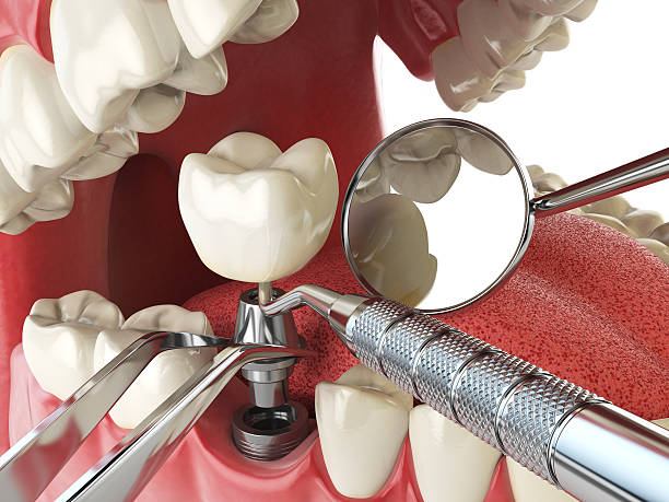 Best Urgent Care for Lost Fillings or Crowns in Walkersville, MD
