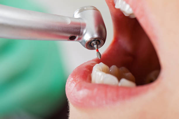 Best Emergency Denture Repair in Walkersville, MD